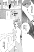 Klinefelter Syndrome 020